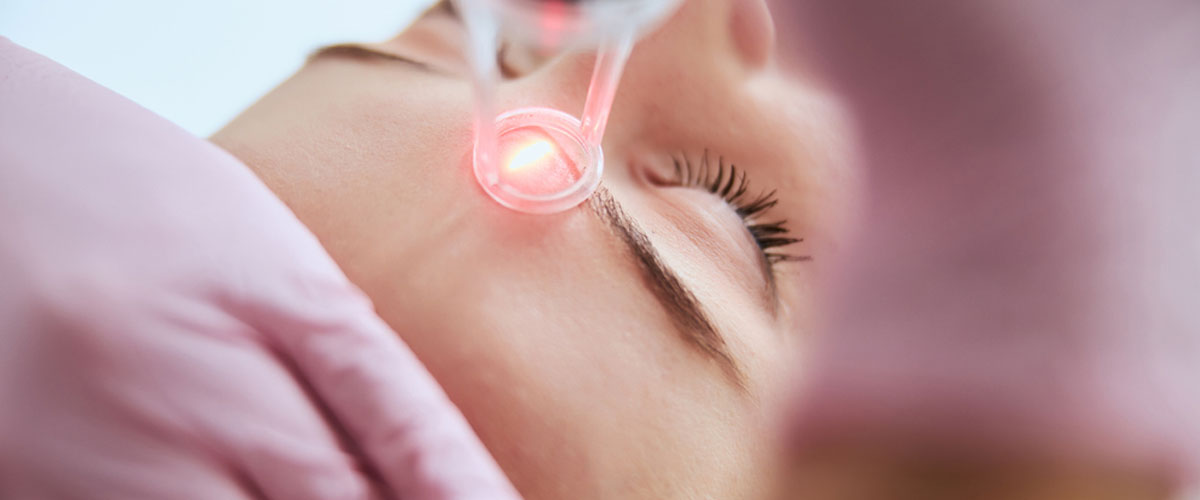 CO2 Fractional Laser treatment in Mumbai by Dr. Gunjan Gangaraju