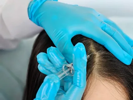 GFC Hair Treatment Benefits