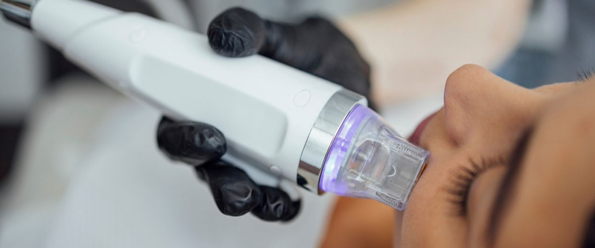 Microneedling Radio Frequency treatment in Mumbai by Dr. Gunjan Gangaraju