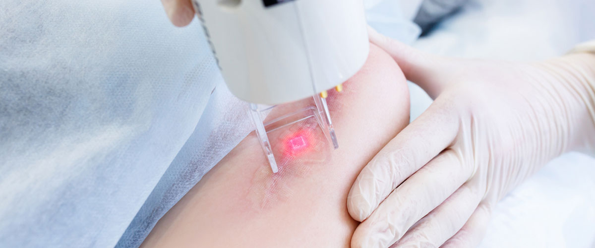 Scar Treatment in Mumbai by Dr. Gunjan Gangaraju